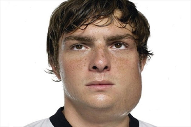 Get The Facts About Mumps