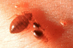 Image of bed bugs feeding on skin